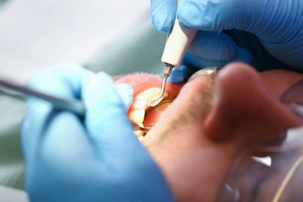 Best Cosmetic Emergency Dentistry in Leisure Knoll, NJ